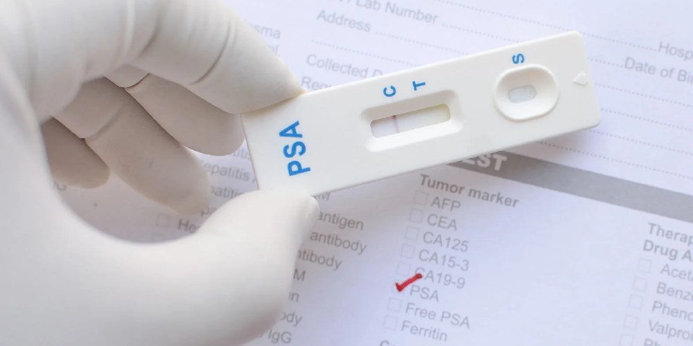 El Antígeno Prostático Específico (PSA) en el ámbito forense